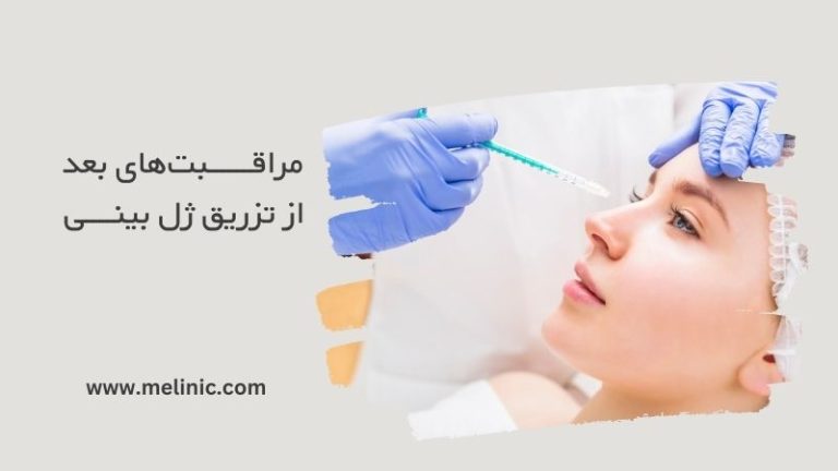 مراقبت‌های بعد از تزریق ژل بینی