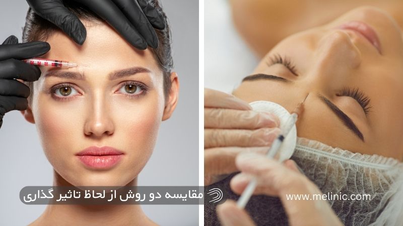 کدام روش برای خط اخم مؤثرتر است؟