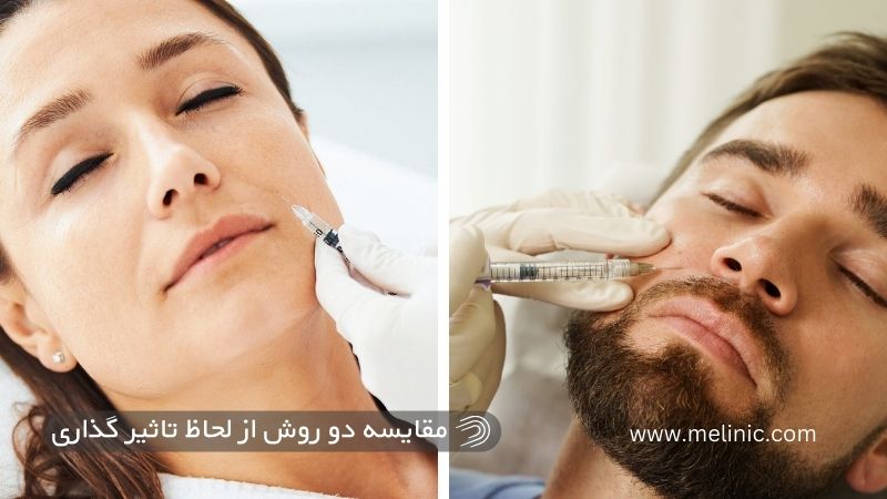 کدام روش برای رفع خط خنده مؤثرتر است؟