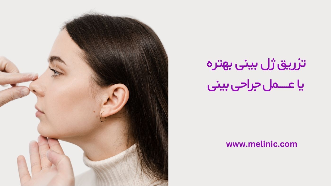 تزریق ژل بینی بهتره یا عمل بینی