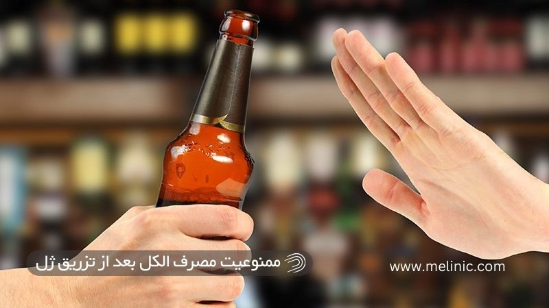 ممنوعیت مصرف الکل بعد از تزریق ژل 