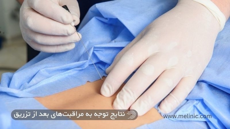 مزایای توجه به مراقبت های بعد از تزریق ژل بدن