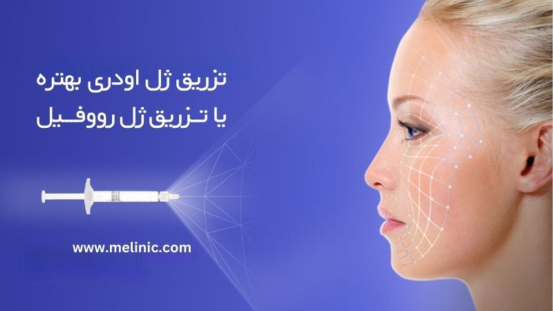 تزریق ژل اودری بهتره یا رووفیل