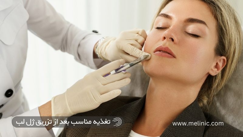 تغذیه بعد از تزریق ژل لب