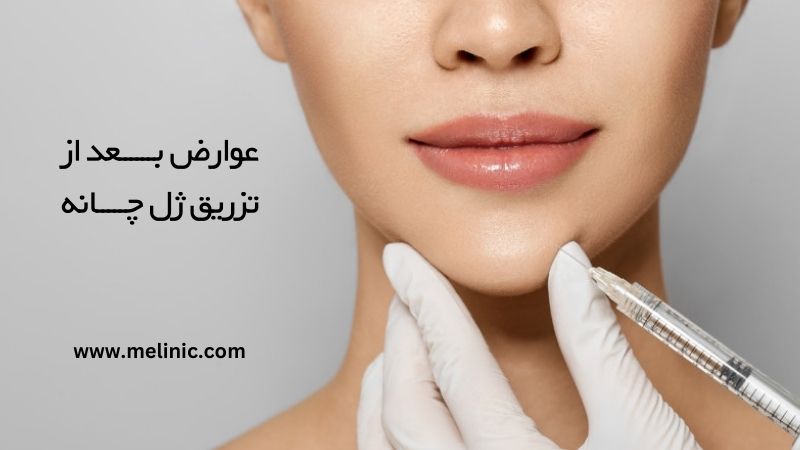 عوارض بعد از تزریق ژل چانه