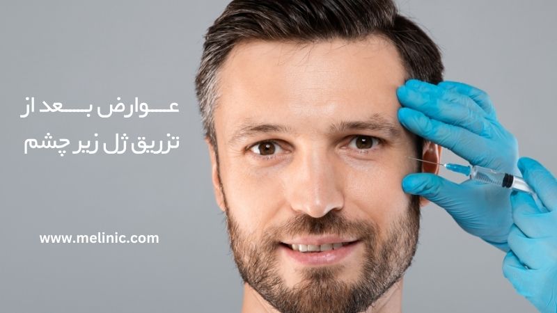 عوارض بعد از تزریق ژل زیر چشم