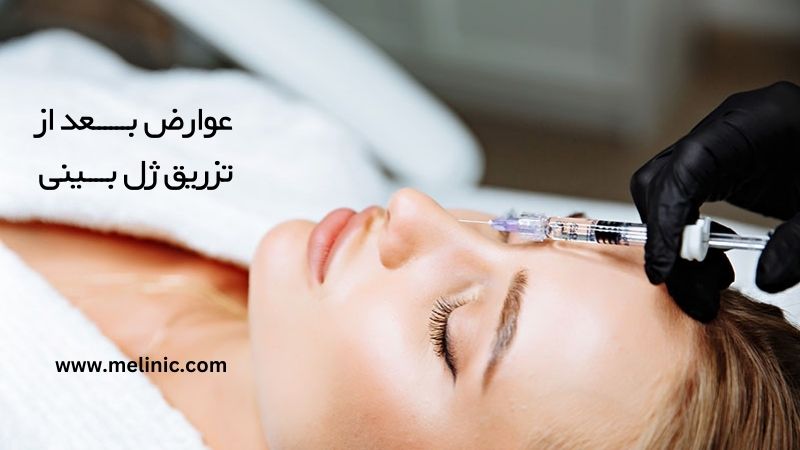 عوارض بعد از تزریق ژل بینی