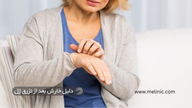 دلیل خارش بعد از تزرق ژل