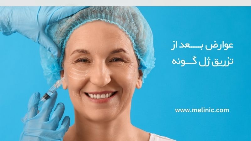 عوارض بعد از تزریق ژل گونه