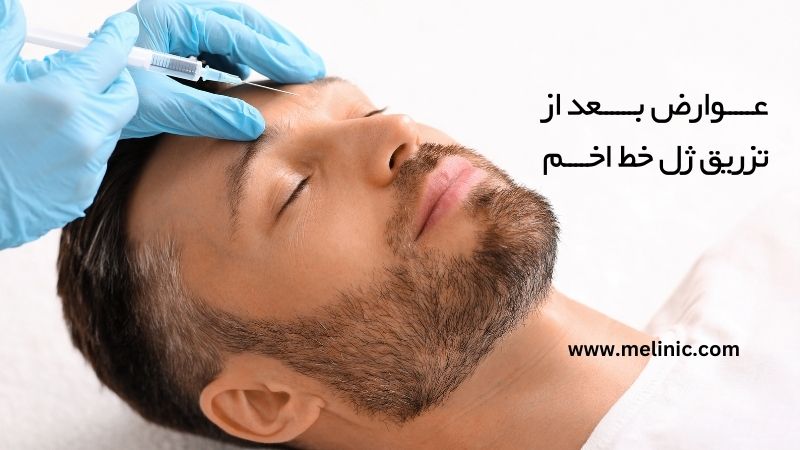 عوارض بعد از تزریق ژل خط اخم