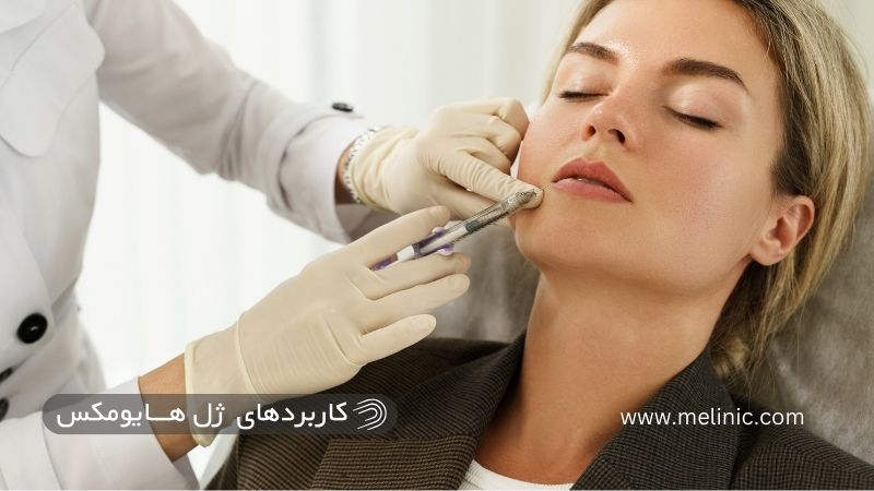 کاربردهای فیلر هایومکس