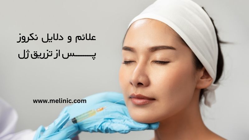 علائم و دلایل نکروز پس از تزریق ژل