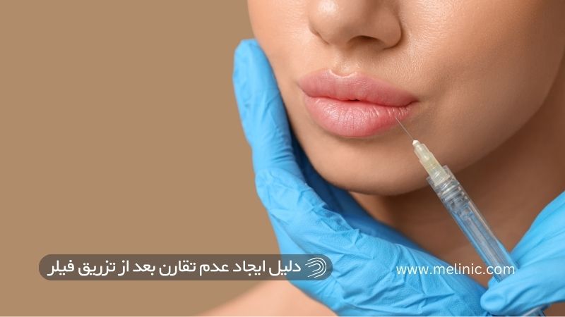 دلیل ایجاد عدم تقارن بعد از تزریق ژل  