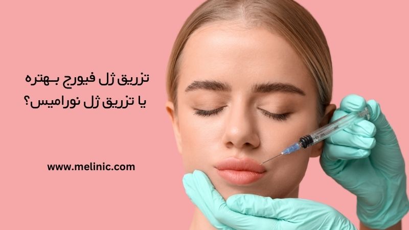 تزریق ژل فیورج بهتره یا نورامیس؟