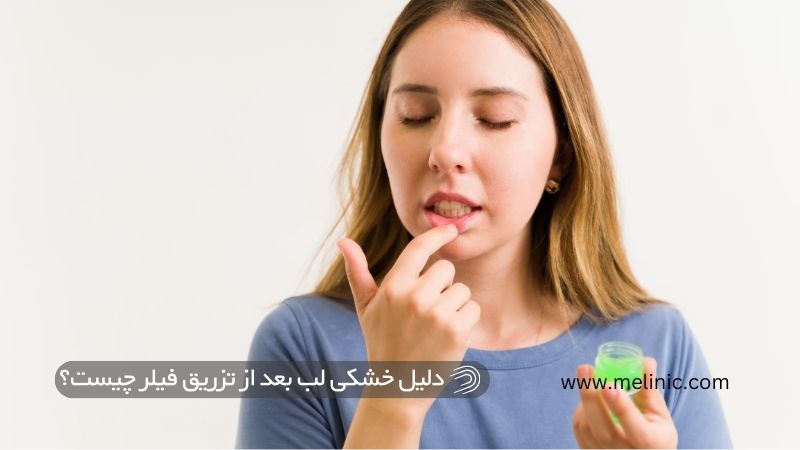 دلیل خشکی لب بعد از تزریق فیلر چیست؟