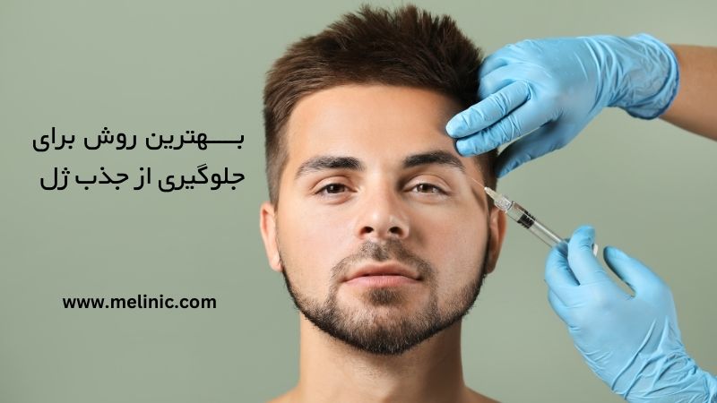 بهترین روش برای جلوگیری از جذب ژل چیست؟